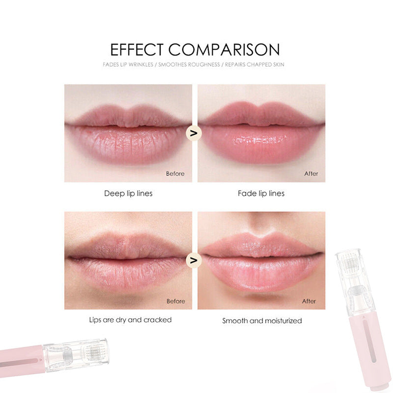R&G Boutique 3-in-1 lip care and hair growth roller with needle treatment for beard and serum application in a beauty product image.